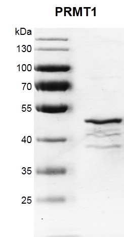 Recombinant PRMT1 protein gel. PRMT1 protein was run on a 10% SDS-PAGE gel and stained with Coomassie blue.