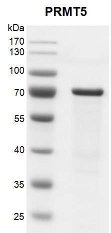 Recombinant PRMT5 protein gel. PRMT5 protein was run on a 10% SDS-PAGE gel and stained with Coomassie Blue. MW: 74.2 kDa Purity: > 95%