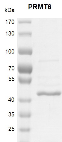 Recombinant PRMT6 protein gel. PRMT6 protein was run on a 10% SDS-PAGE gel and stained with Coomassie blue.