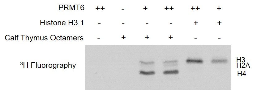 PRMT6 activity assay. 30 ng/ul Recombinant Histone H3.1 (Cat# 31294) or 60 ng/ul Calf Thymus Octamer were incubated with 15 ng/ul PRMT6 (+) and 30 ng/ul PRMT6(++), respectively, in reaction buffer for 3 hours at room temperature. Activity was detected by fluorography.