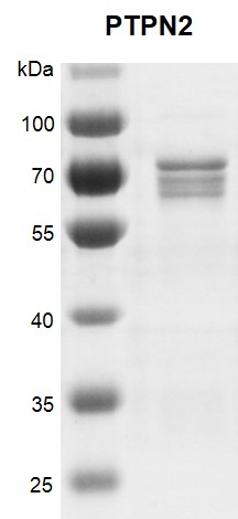 Recombinant PTPN2 protein gel. Recombinant PTPN2 protein was run on a 12% SDS-PAGE gel and stained with Coomassie Blue. MW: 75.7 kDa Purity: > 50%