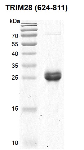 Recombinant TRIM28 (624-811) protein gel. TRIM28 (624-811) protein was run on an SDS-PAGE gel and stained with Coomassie Blue.