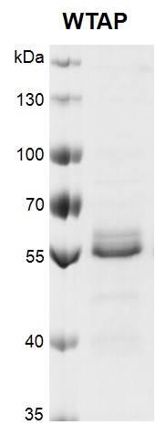 Recombinant WTAP protein gel. Recombinant WTAP protein was run on an 8% SDS-PAGE gel and stained with Coomassie blue.