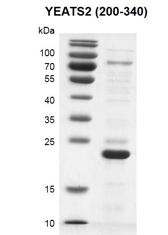 Recombinant YEATS2 (200-340) protein gel 12.5% SDS-PAGE Coomassie staining MW: 21.5 kDa Purity: >80% 	