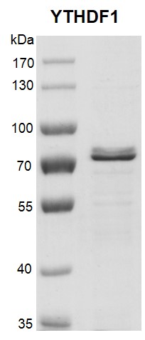 Recombinant YTHDF1 protein gel. Recombinant YTHDF1 protein was run on an 8% SDS-PAGE gel and stained with Coomassie Blue. MW: 62.1 kDa Purity: > 80%