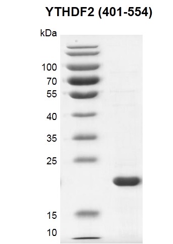 Recombinant YTHDF2 (401-554) SDS PAGE gel 12.5% SDS-PAGE Coomassie staining MW: 22.7 kDa Purity: >85% 	