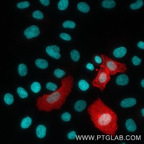 HeLa cells transfected with human Mesothelin were live immunostained with CoraLite Plus 555 conjugated MSLN VHH (1:500, red). Nuclei were stained with DAPI (blue or cyan) after cell fixation. Epifluorescence images were acquired with a 20x objective and post-processed. 
Comment: Immunostaining with CoraLite Plus 555 conjugated MSLN VHH can be performed live or after formaldehyde fixation.