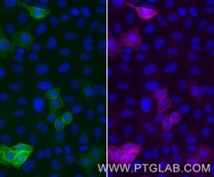 Live HeLa cells transfected with human TIGIT were probed with human recombinant anti-TIGIT IgG. After formaldehyde fixation, the cells were immunostained with CoraLite® Plus 647 conjugated-TIGIT VHH (CL647-tgt,1:1000, magenta) and with anti-human IgG Nano-Secondary (shuGCL488-2, green). Cell nuclei were stained with DAPI (blue). 
Epifluorescence images were acquired with 20x objective and post-processed.