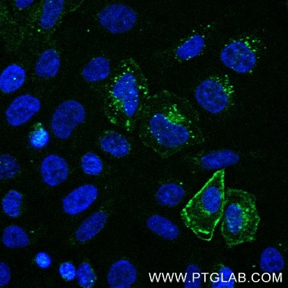 HeLa cells transfected with human CTLA-4 were immunostained with FITC Plus conjugated-CTLA4 VHH (FITC-ctl) (1:500, green). Nuclei were stained with DAPI (blue). Epifluorescence images were acquired with a 40x objective and post-processed. 
Comment: Immunostaining with FITC-ctl can be performed live or after formaldehyde fixation.