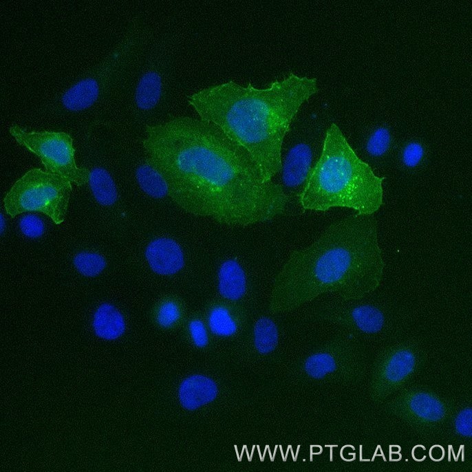 HeLa cells transfected with human FLT-3 were immunostained with FITC Plus conjugated FLT3 VHH (1:500, green). Nuclei were stained with DAPI (blue or cyan). Epifluorescence images were acquired with a 20x objective and post-processed. 
Comment: Immunostaining with FITC Plus conjugated FLT3 VHH can be performed live or after formaldehyde fixation.