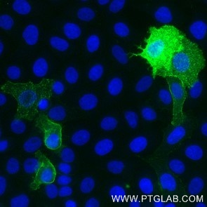 HeLa cells transfected with human Mesothelin were live immunostained with FITC Plus conjugated MSLN VHH (1:500, green). Nuclei were stained with DAPI (blue or cyan) after cell fixation. Epifluorescence images were acquired with a 20x objective and post-processed. 
Comment: Immunostaining with FITC Plus conjugated MSLN VHH can be performed live or after formaldehyde fixation.