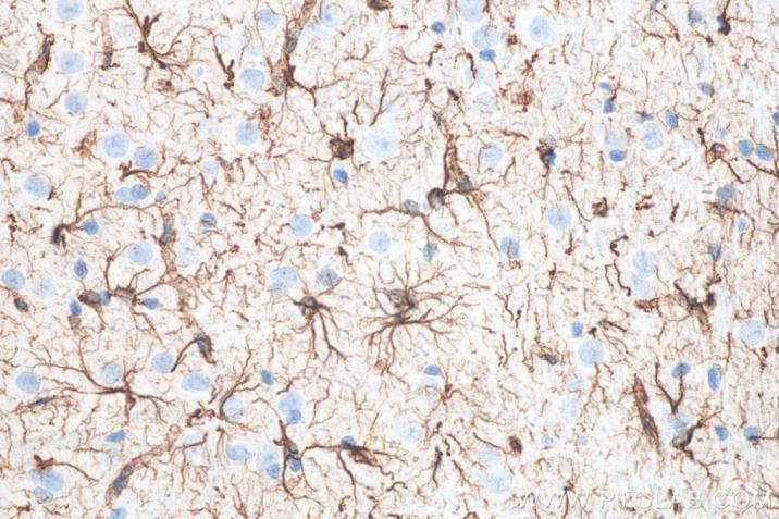 IHC analysis of rat brain tissue using Proteintech’s GFAP mouse monoclonal antibody (60190-1-Ig) and IHC Detect Kit for Mouse Primary Antibody (PK10010).
