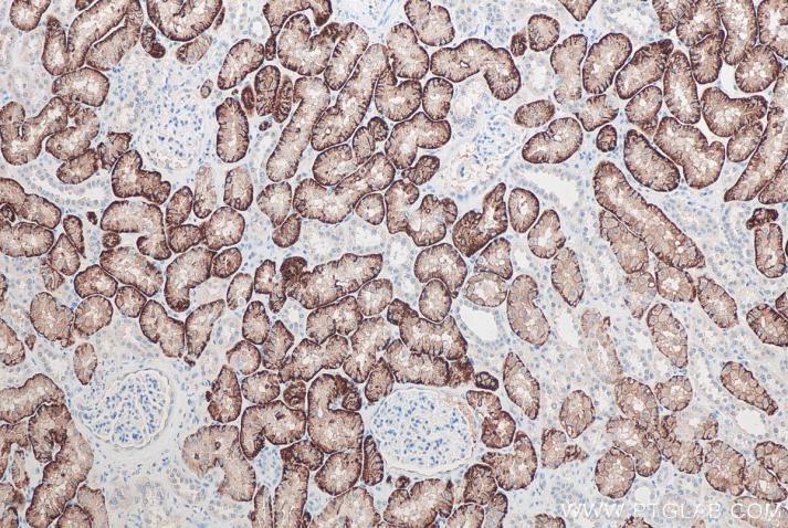 IHC analysis of human kidney tissue using Proteintech’s SLC13A3 rabbit polyclonal antibody (26184-1-AP) and IHC Prep & Detect Kit for Rabbit/Mouse Primary Antibody (PK10019).