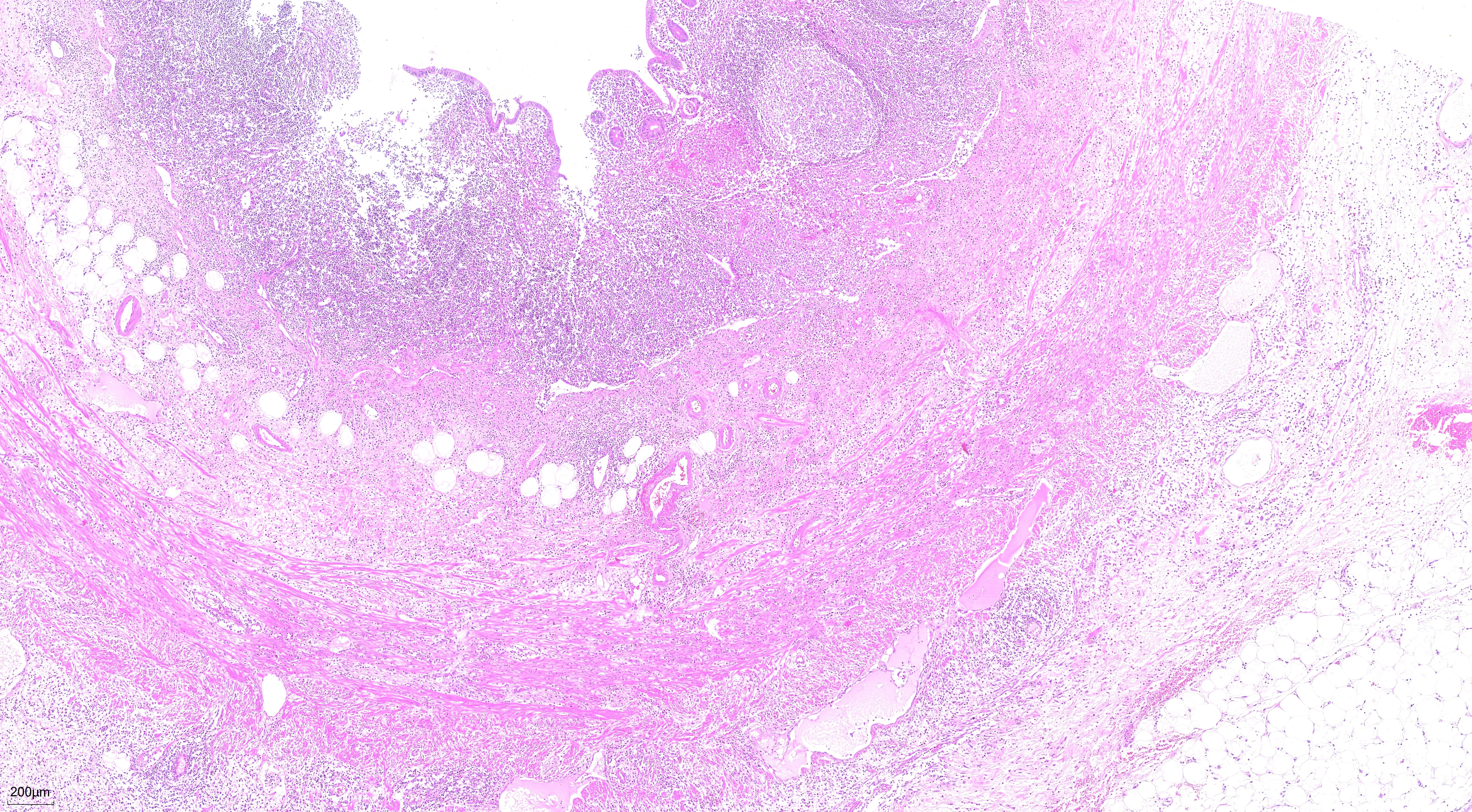 FFPE human appendicitis tissue was stained with PK10031 (H&E Staining Kit).