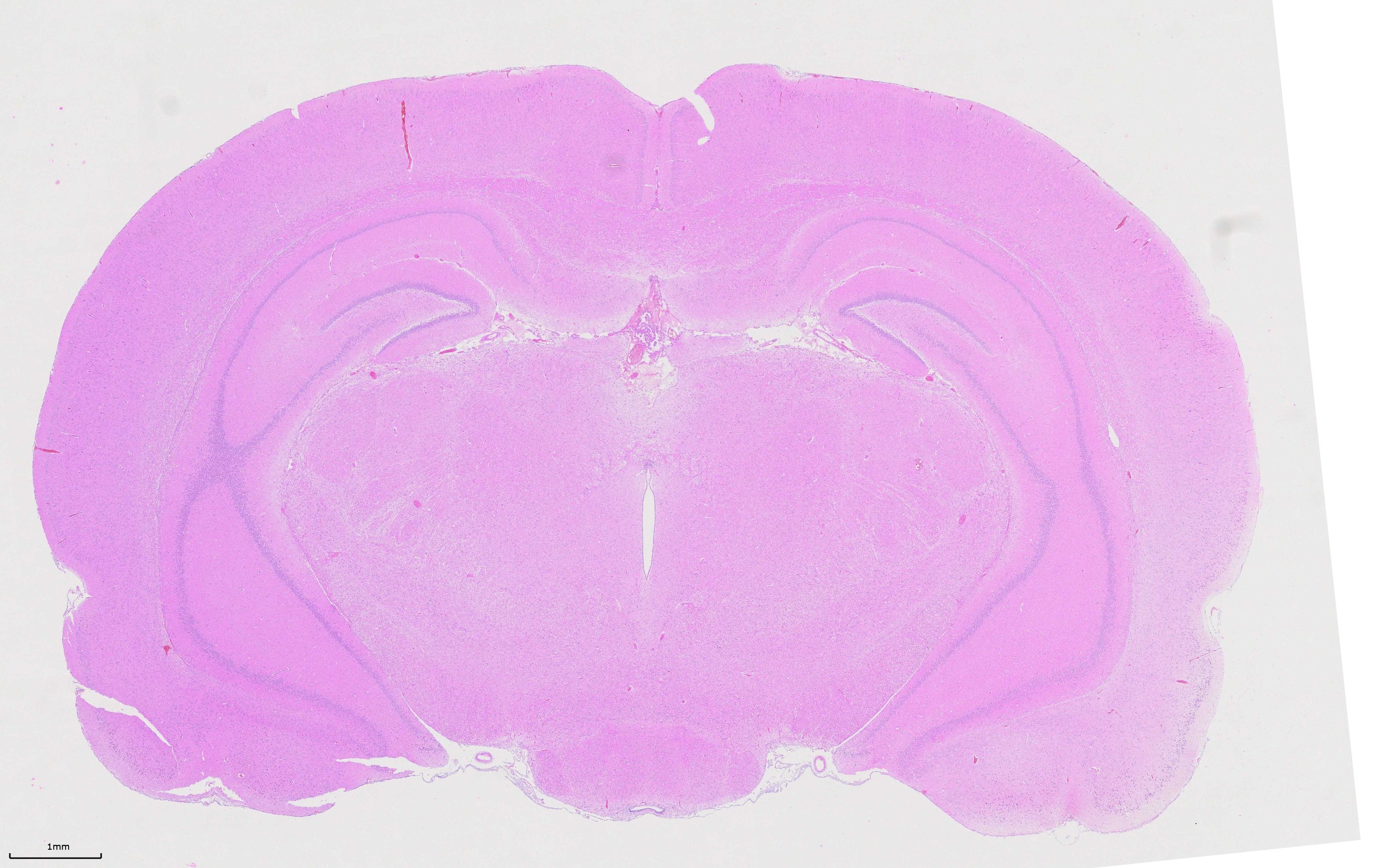  FFPE rat brain tissue was stained with PR30004 (Mayer's Hematoxylin Solution) and PR30019 (Eosin Staining Solution).
