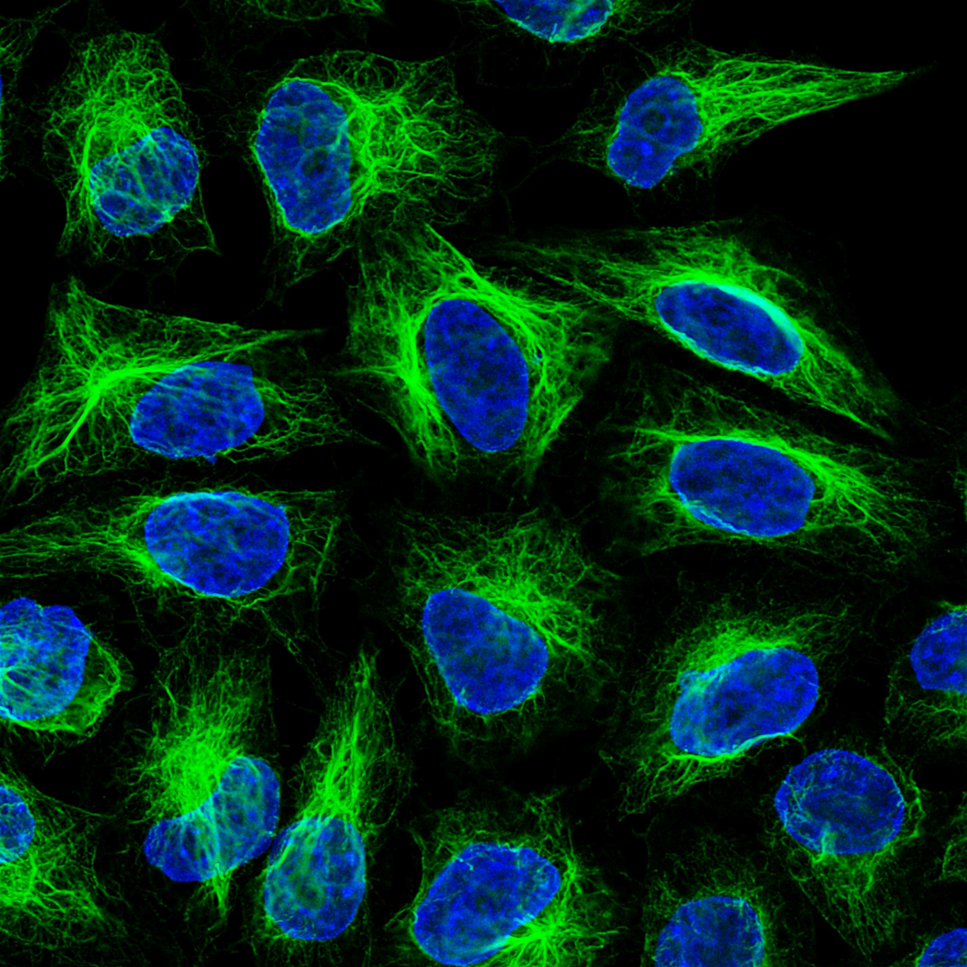 Immunofluorescence analysis of HeLa cells stained with mouse IgG1 anti-vimentin antibody and Nano-Secondary® alpaca anti-mouse IgG1, recombinant VHH, CoraLite® Plus 488 (smsG1CL488-1, green). Nuclei were stained with DAPI (blue). Images were recorded at the Core Facility Bioimaging at the Biomedical Center, LMU Munich.