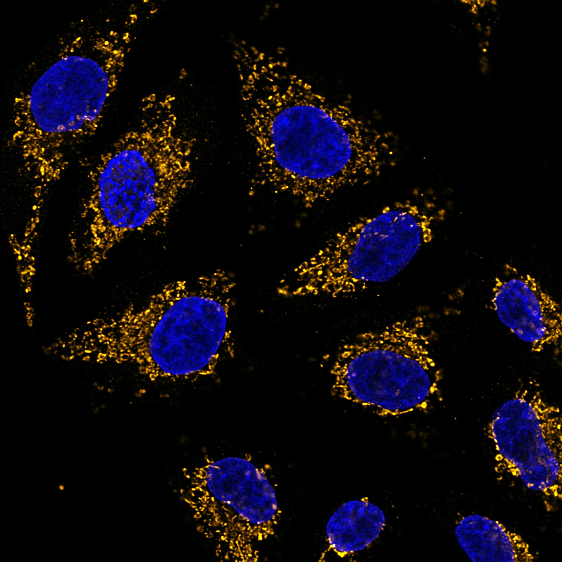 Immunofluorescence analysis of HeLa cells stained with mouse IgG1 anti-HSP60 antibody (66041-1-Ig) and Nano-Secondary® alpaca anti-mouse IgG1, recombinant VHH, CoraLite® Plus 555 (smsG1CL555-1, orange). Nuclei were stained with DAPI (blue). Images were recorded at the Core Facility Bioimaging at the Biomedical Center, LMU Munich.