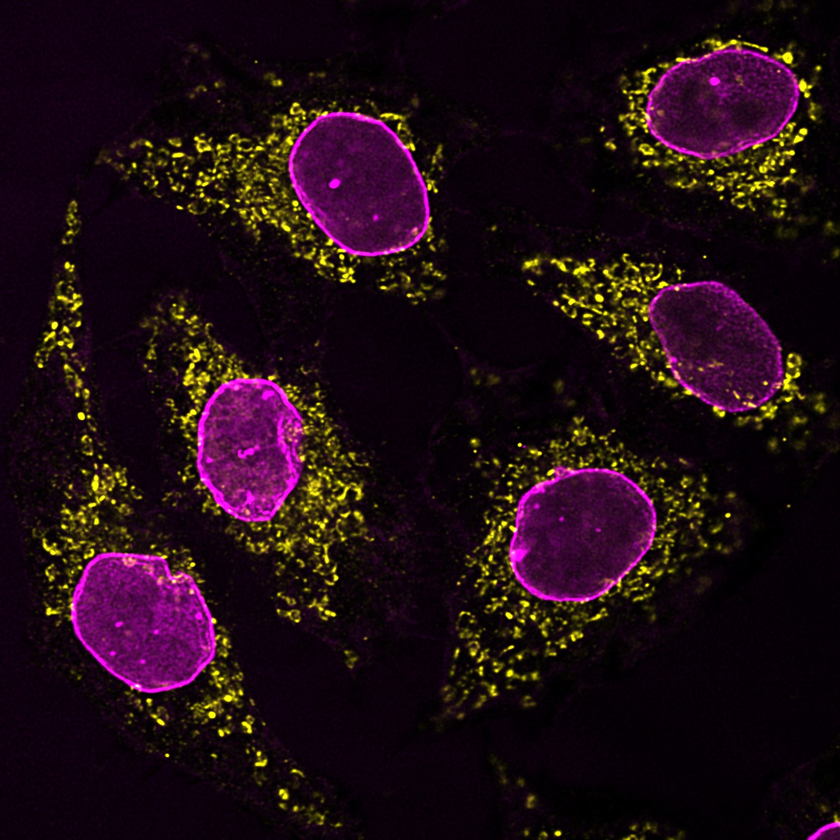 Immunofluorescence analysis of HeLa cells co-stained with mouse IgG1 anti-HSP60 antibody (66041-1-Ig) and mouse IgG2b anti-Lamin A/C antibody followed by Nano-Secondary® alpaca anti-mouse IgG1, recombinant VHH, CoraLite® Plus 555 (smsG1CL555-1, yellow) and Nano-Secondary® alpaca anti-mouse IgG2b, recombinant VHH, CoraLite® Plus 647 (smsG1CL647-1, magenta). Images were recorded at the Core Facility Bioimaging at the Biomedical Center, LMU Munich.