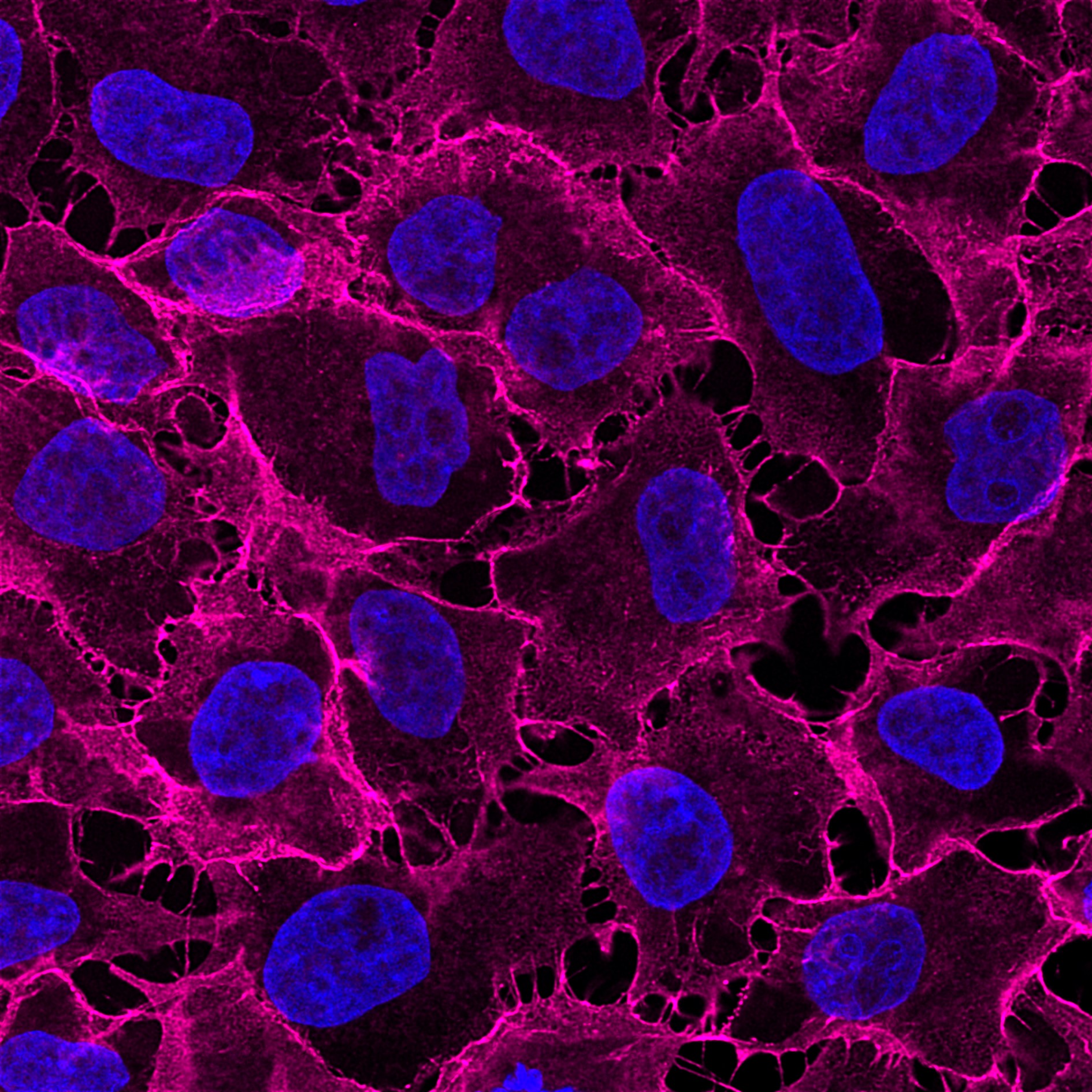 Immunofluorescence analysis of HeLa cells stained with mouse IgG1 anti-CD147 antibody and Nano-Secondary® alpaca anti-mouse IgG1, recombinant VHH, CoraLite® Plus 647 (smsG1CL647-1, magenta). Nuclei were stained with DAPI (blue). Images were recorded at the Core Facility Bioimaging at the Biomedical Center, LMU Munich.