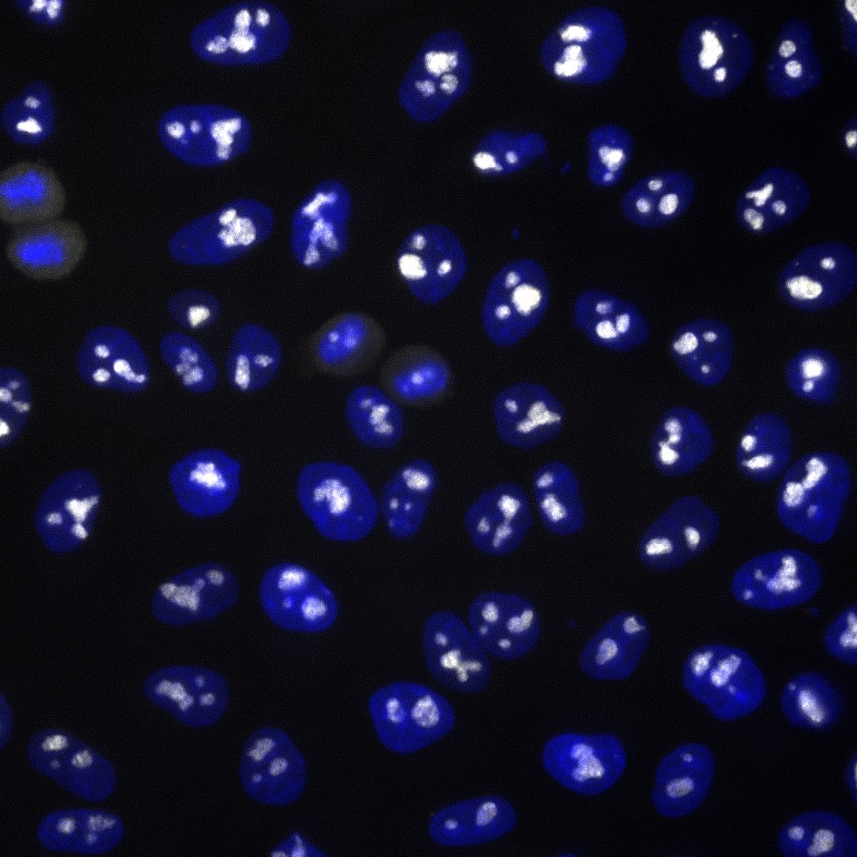 Immunofluorescence analysis of HeLa cells stained with mouse IgG1 anti-B23 antibody and Nano-Secondary® alpaca anti-mouse IgG1, recombinant VHH, CoraLite® Plus 750 (smsG1CL750-1, white). Nuclei were stained with DAPI (blue).