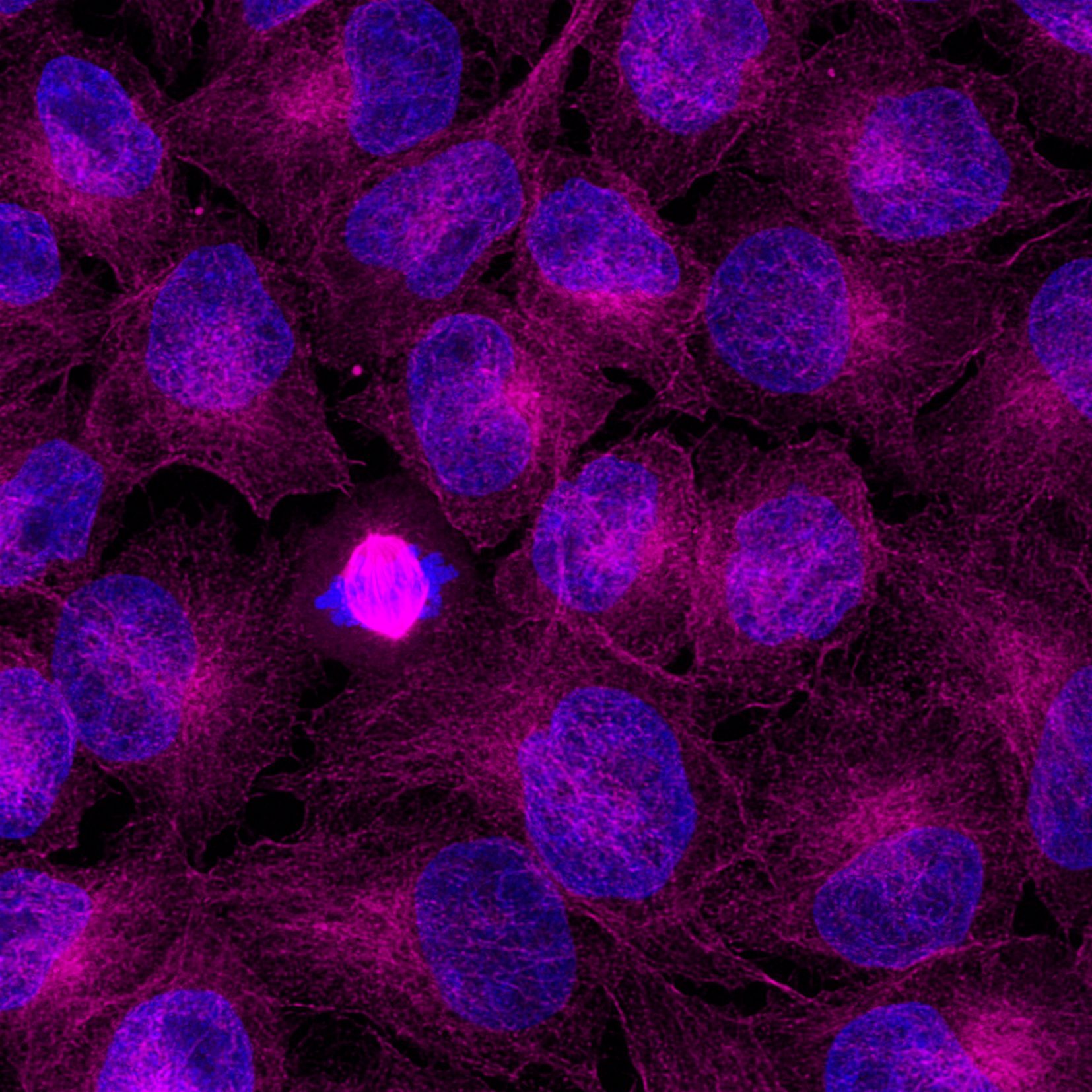 Immunofluorescence analysis of Hela cells stained with mouse IgG2a anti-Tubulin antibody (66240-1-Ig) and Nano-Secondary® alpaca anti-mouse IgG2a, recombinant VHH, CoraLite® Plus 647 (magenta). Nuclei were stained with DAPI (blue). Images were recorded at the Core Facility Bioimaging at the Biomedical Center, LMU Munich.