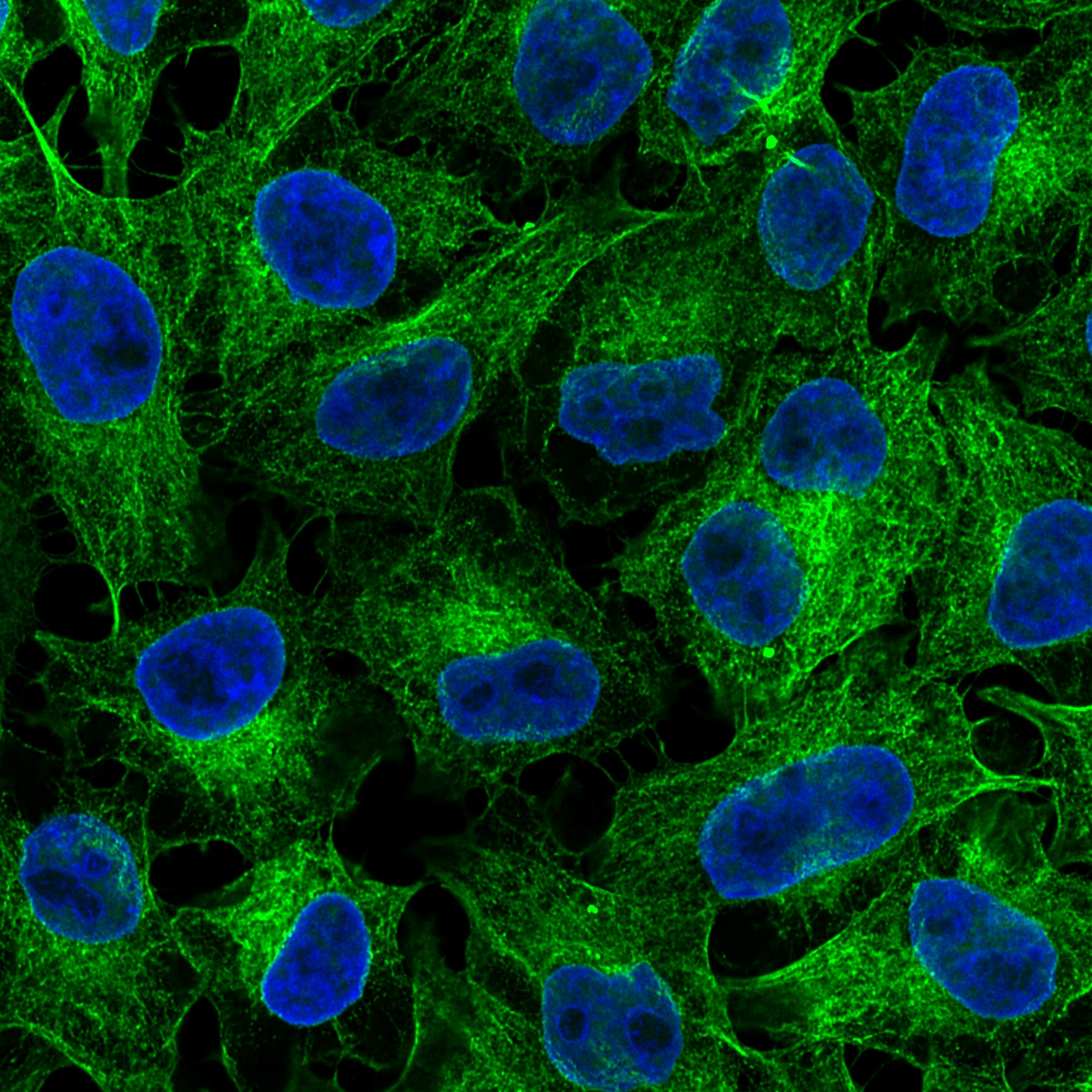 Immunofluorescence analysis of HeLa cells stained with mouse IgG2b anti-tubulin beta antibody and Nano-Secondary® alpaca anti-mouse IgG2b, recombinant VHH, CoraLite® Plus 488 (smsG2bCL488-1, green). Nuclei were stained with DAPI (blue). Images were recorded at the Core Facility Bioimaging at the Biomedical Center, LMU Munich.
