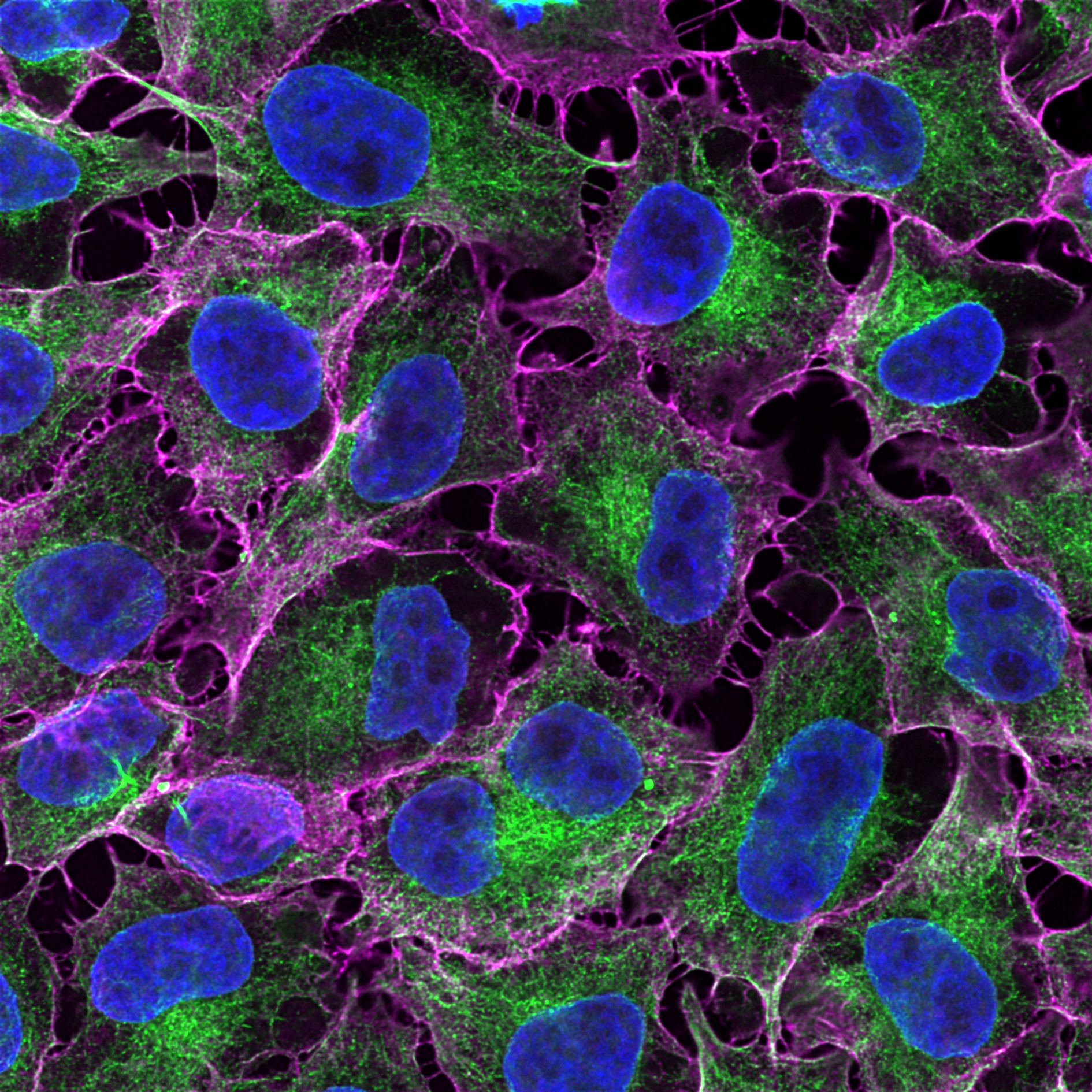 Immunofluorescence analysis of HeLa cells co-stained with mouse IgG2b anti-tubulin beta antibody and mouse IgG1 CD147 antibody followed by Nano-Secondary® alpaca anti-mouse IgG2b, recombinant VHH, CoraLite® Plus 488 (smsG2bCL488-1, green) and Nano-Secondary® alpaca anti-mouse IgG1, recombinant VHH, CoraLite® Plus 647 (smsG1CL647-1, magenta). Nuclei were stained with DAPI (blue). Images were recorded at the Core Facility Bioimaging at the Biomedical Center, LMU Munich.