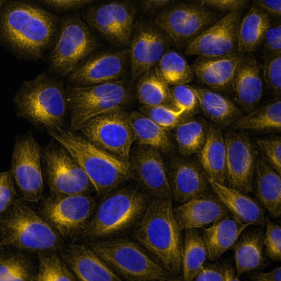 Immunofluorescence analysis of HeLa cells stained with mouse IgG2b anti-Tubulin beta antibody and Nano-Secondary® alpaca anti-mouse IgG2b, recombinant VHH, CoraLite® Plus 555 (smsG2bCL555-1, orange). Nuclei were stained with DAPI (blue). Images were recorded at the Core Facility Bioimaging at the Biomedical Center, LMU Munich.