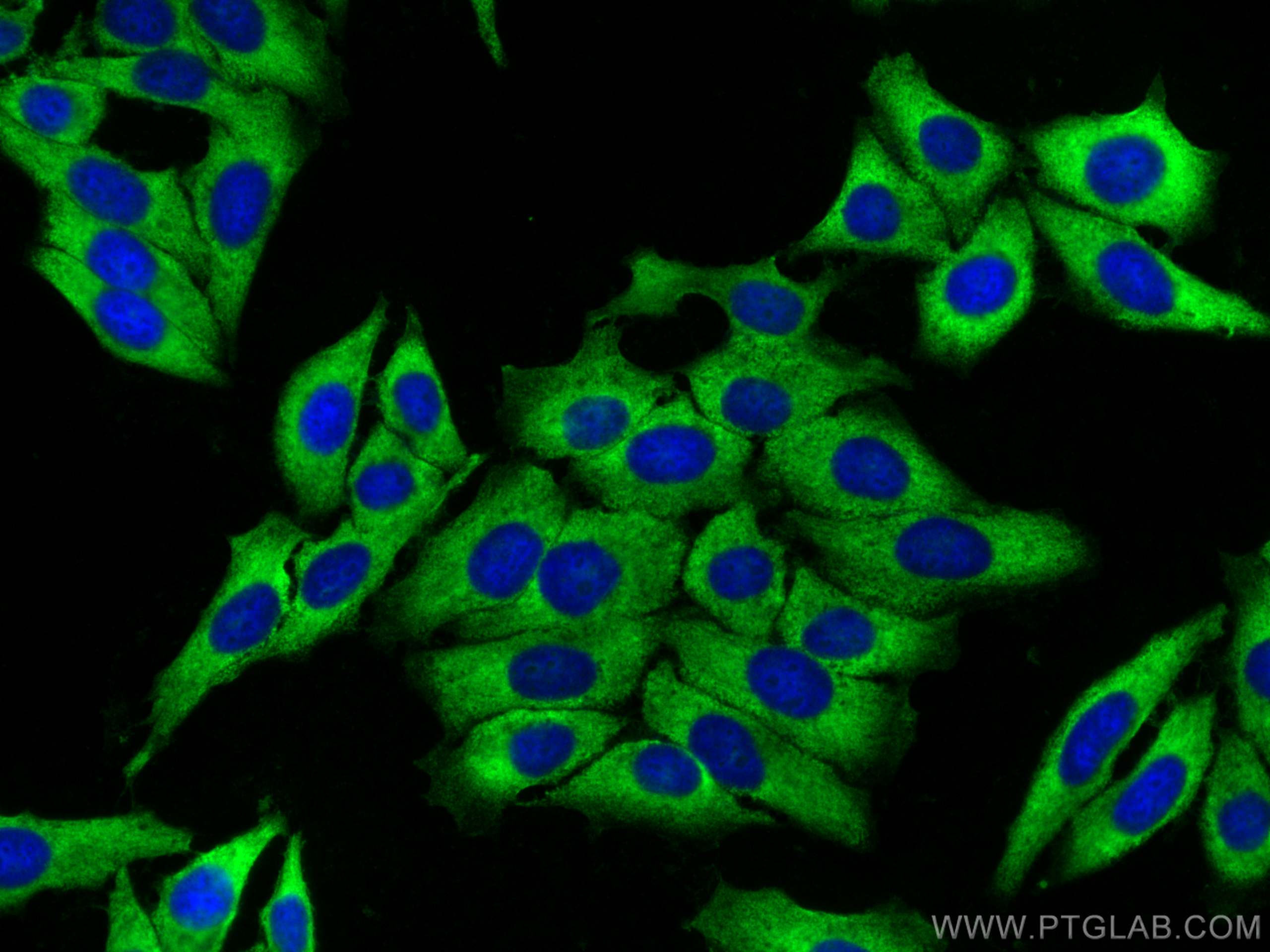 Immunofluorescence (IF) / fluorescent staining of HepG2 cells using Ribosomal protein L4 Polyclonal antibody (30182-1-AP)