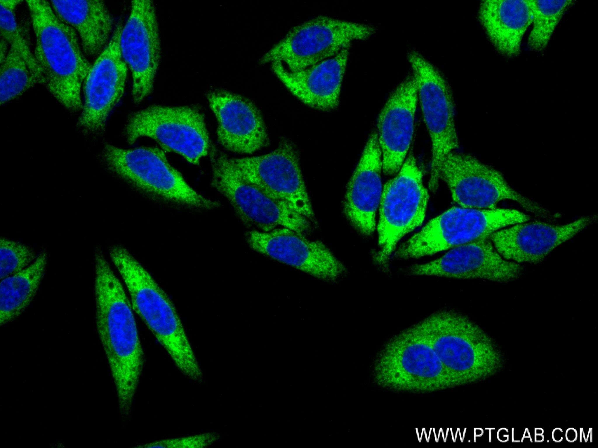 Immunofluorescence (IF) / fluorescent staining of HepG2 cells using Ribosomal protein L4 Recombinant antibody (80959-1-RR)