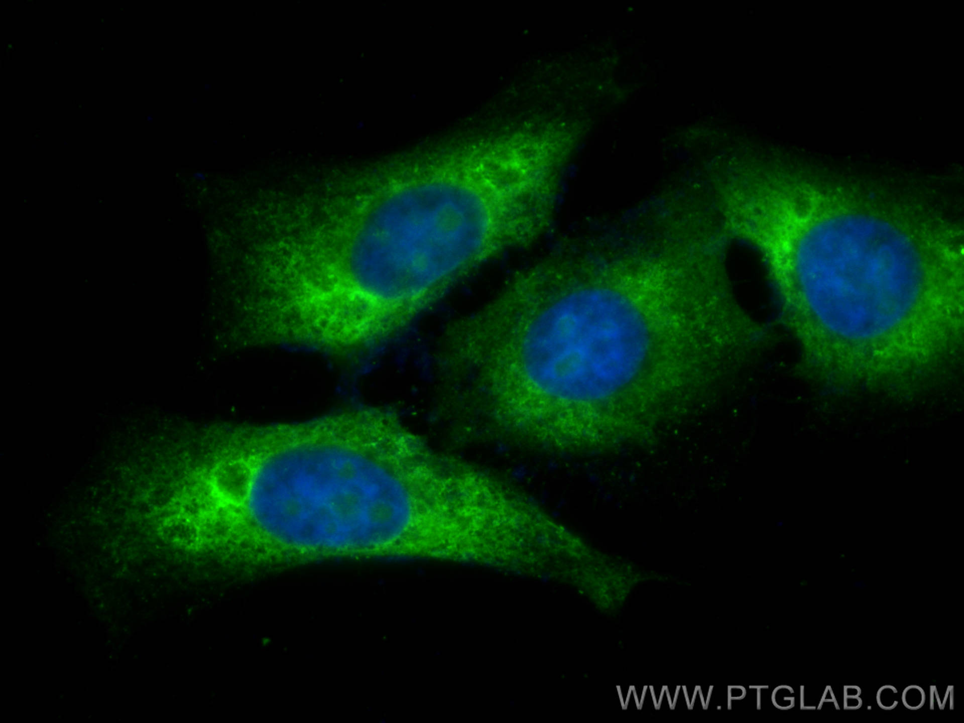 Immunofluorescence (IF) / fluorescent staining of HepG2 cells using CoraLite® Plus 488-conjugated Ribosomal protein L4 (CL488-80959)