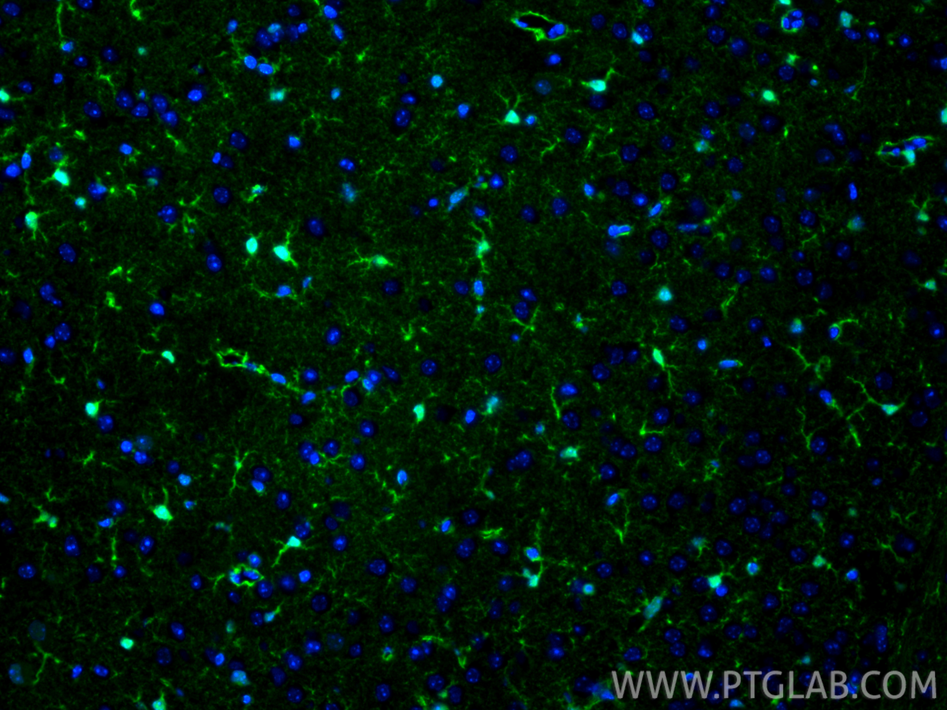 Immunofluorescence (IF) / fluorescent staining of mouse brain tissue using S100B Recombinant antibody (82271-8-RR)