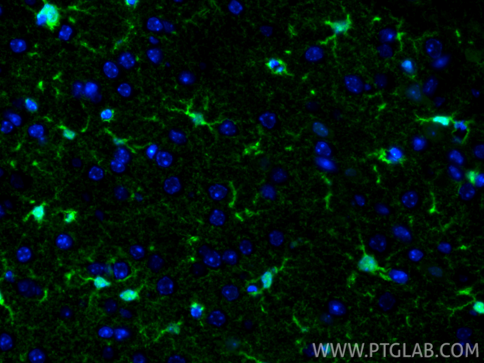 Immunofluorescence (IF) / fluorescent staining of mouse brain tissue using S100B Recombinant antibody (82271-8-RR)