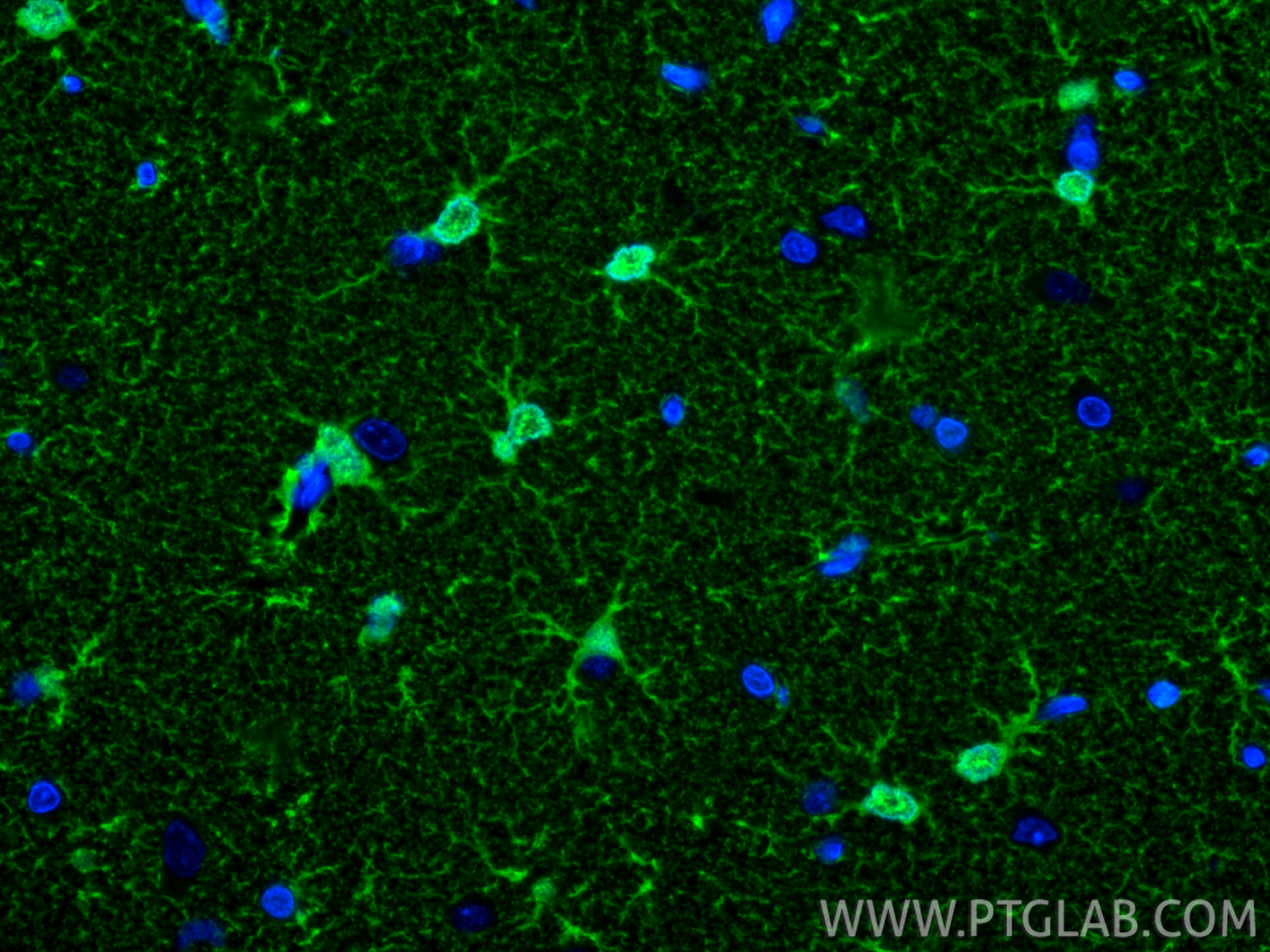 Immunofluorescence (IF) / fluorescent staining of rat brain tissue using S100B Recombinant antibody (82271-8-RR)