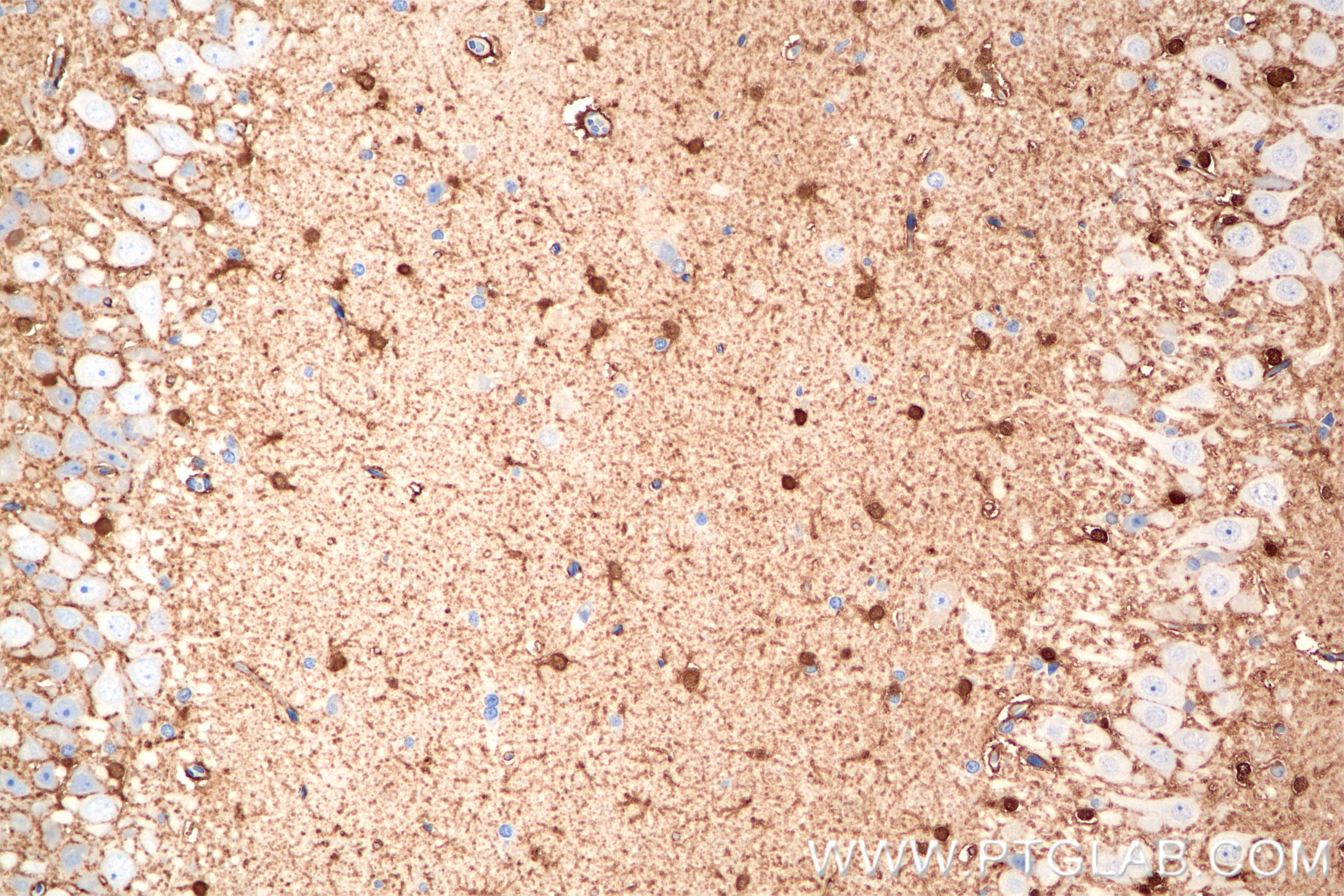 Immunohistochemistry (IHC) staining of rat brain tissue using S100B Recombinant antibody (82271-8-RR)