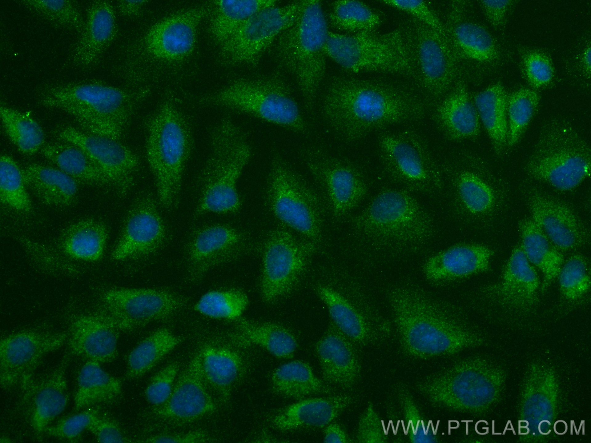 Immunofluorescence (IF) / fluorescent staining of U2OS cells using S100A10 Polyclonal antibody (11250-1-AP)