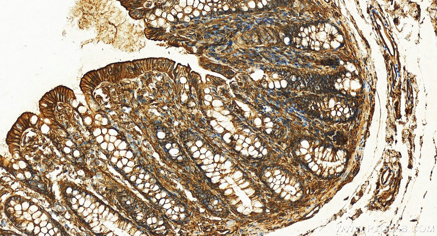 Immunohistochemistry (IHC) staining of human colon tissue using S100A10 Recombinant antibody (81017-1-RR)