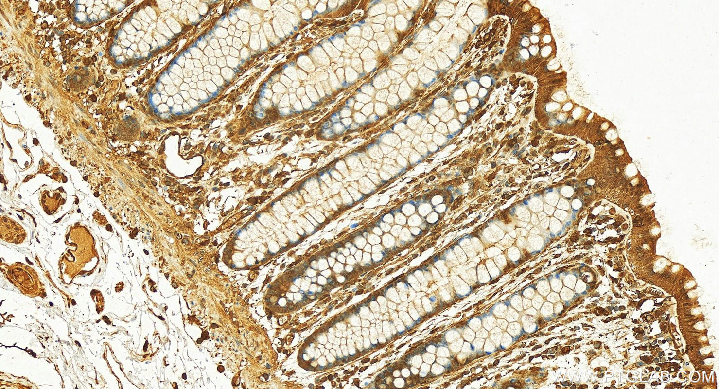 Immunohistochemistry (IHC) staining of human colon tissue using S100A11 Polyclonal antibody (10237-1-AP)