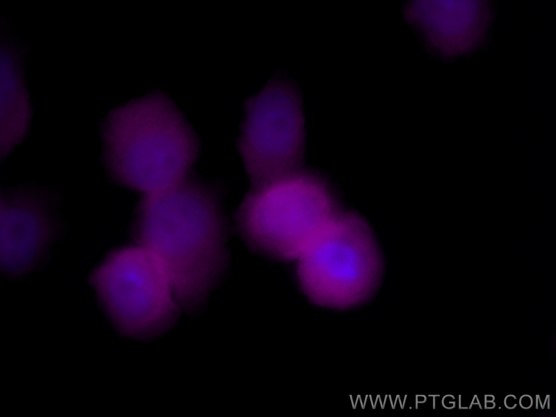 Immunofluorescence (IF) / fluorescent staining of PC-3 cells using CoraLite® Plus 647-conjugated S100A11 Polyclonal a (CL647-10237)