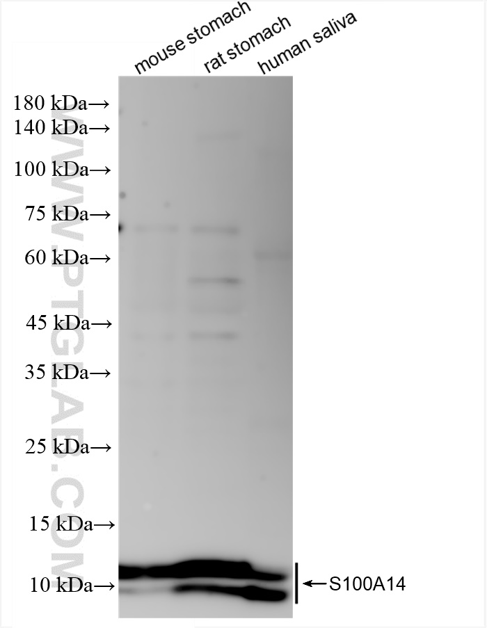 Western Blot (WB) analysis of various lysates using S100A14 Recombinant antibody (83559-5-RR)