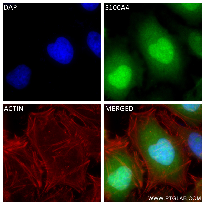 Immunofluorescence (IF) / fluorescent staining of HeLa cells using S100A4 Recombinant antibody (84221-1-RR)