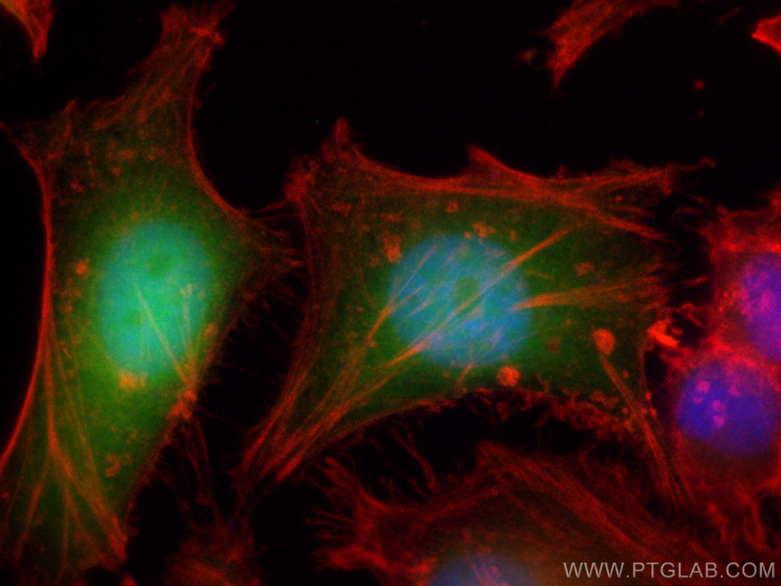 Immunofluorescence (IF) / fluorescent staining of HeLa cells using CoraLite® Plus 488-conjugated FSP1/S100A4 Polyclon (CL488-16105)