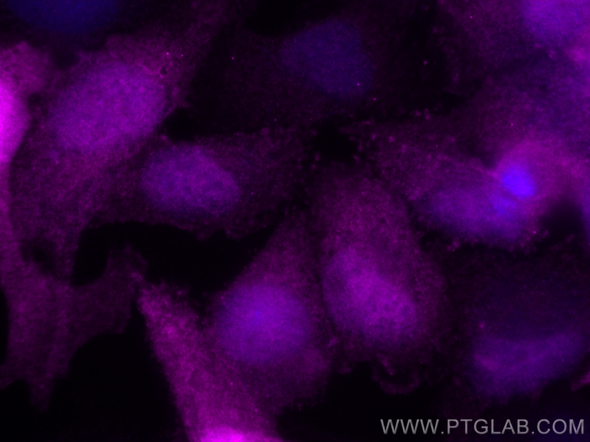 Immunofluorescence (IF) / fluorescent staining of HeLa cells using CoraLite® Plus 647-conjugated S100A4 Monoclonal an (CL647-66489)