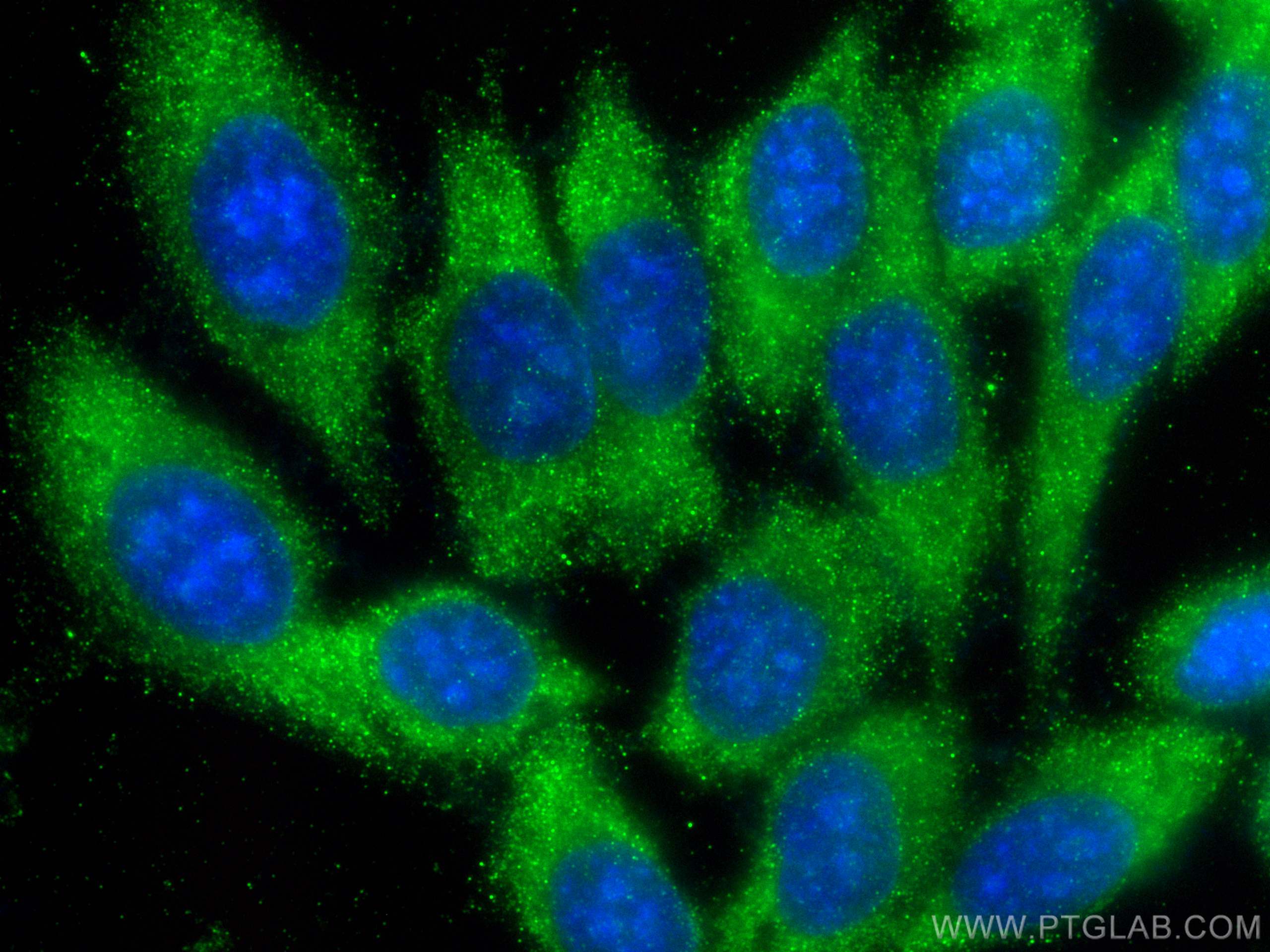 Immunofluorescence (IF) / fluorescent staining of HepG2 cells using S100A6 Monoclonal antibody (66098-1-Ig)