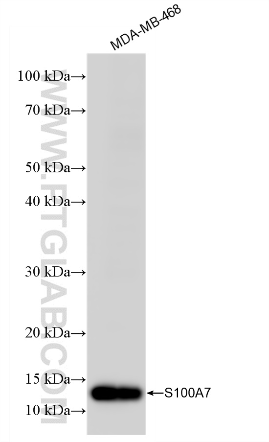 Western Blot (WB) analysis of various lysates using S100A7/Psoriasin Recombinant antibody (85993-1-RR)