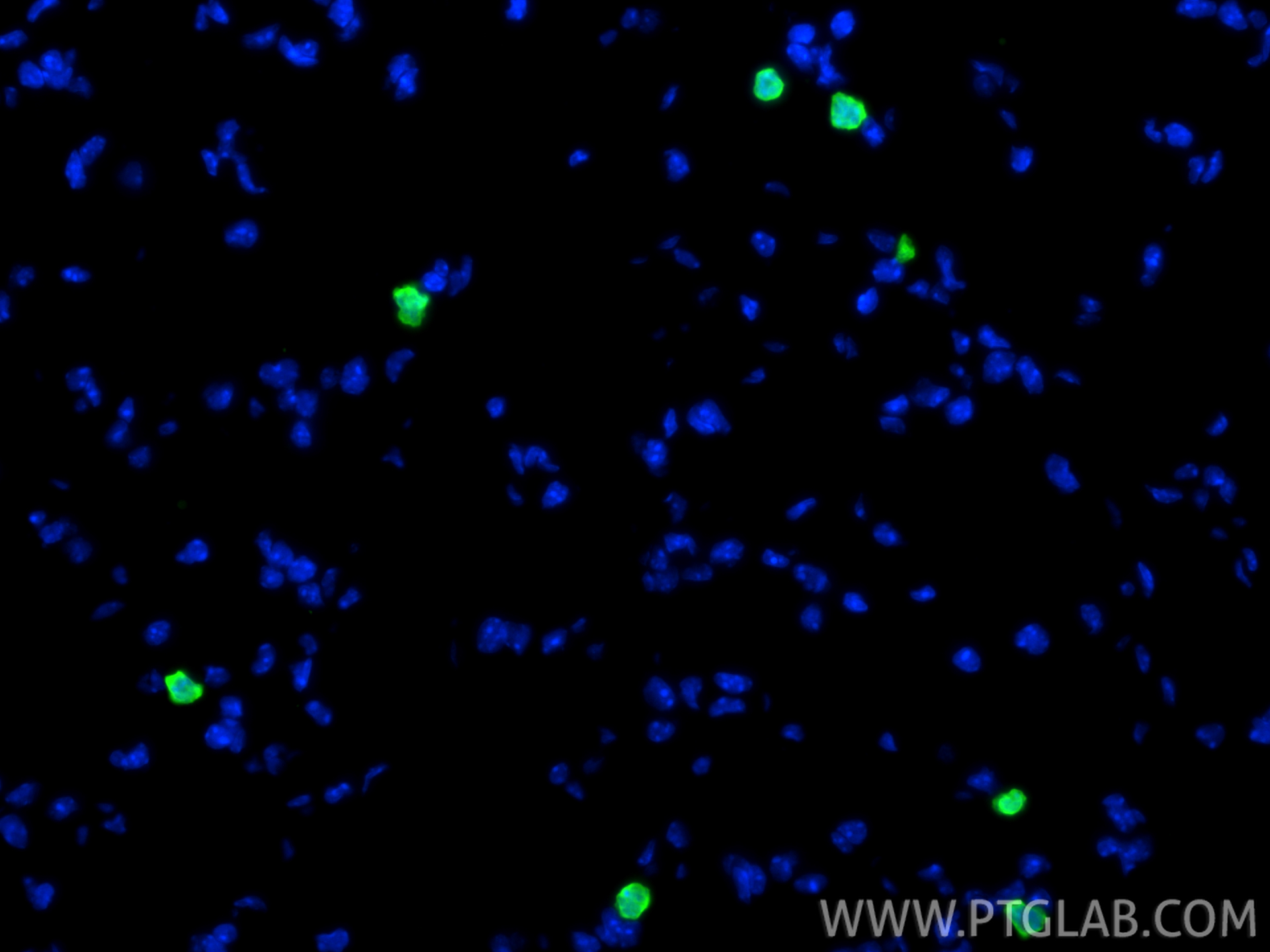 Immunofluorescence (IF) / fluorescent staining of mouse lung tissue using S100A8 Polyclonal antibody (15792-1-AP)