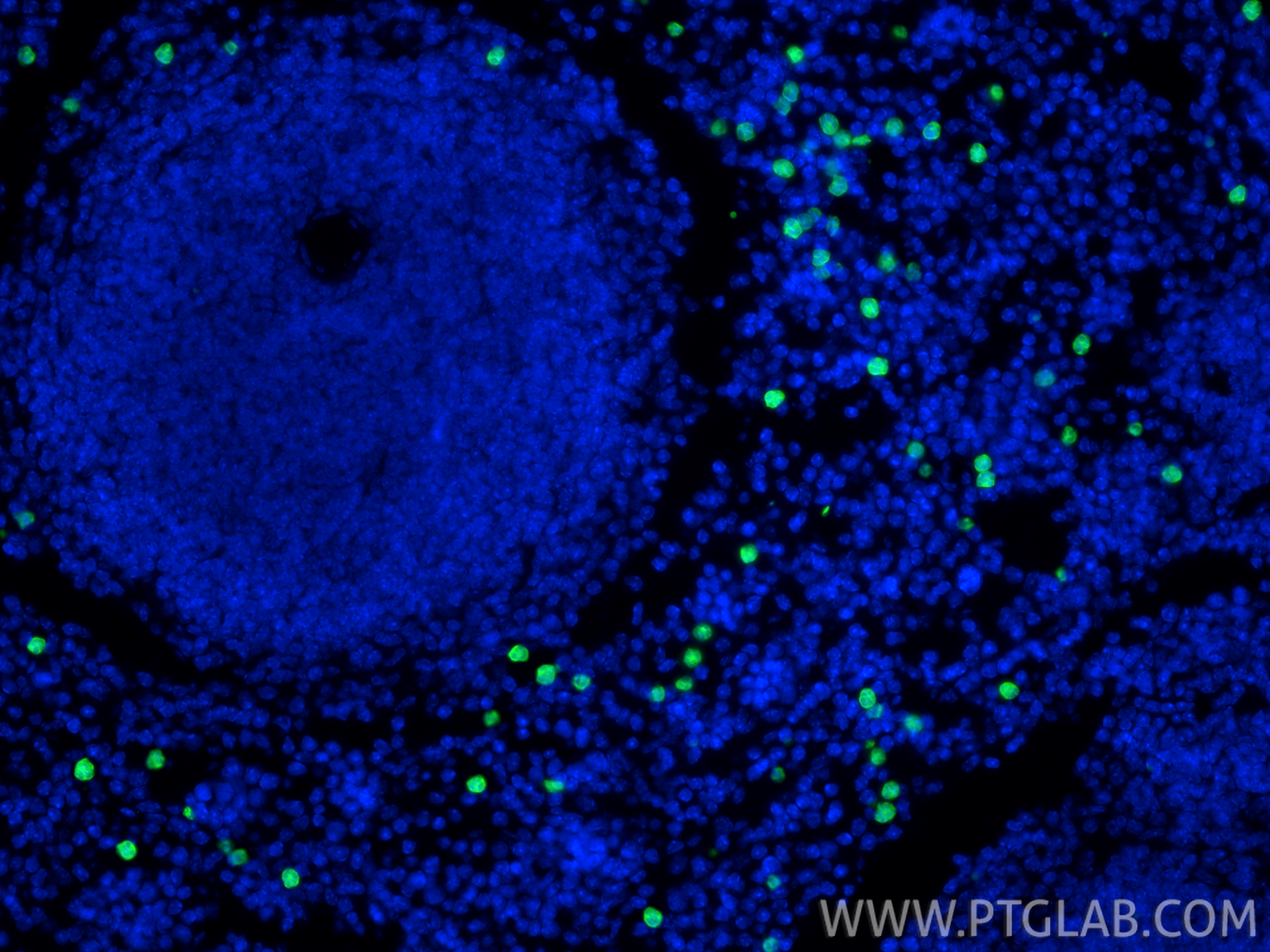 Immunofluorescence (IF) / fluorescent staining of mouse spleen tissue using S100A8 Polyclonal antibody (15792-1-AP)