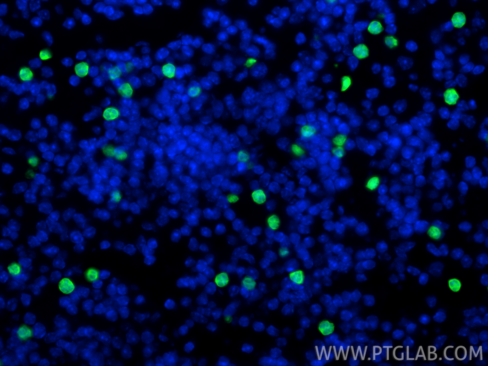 Immunofluorescence (IF) / fluorescent staining of mouse spleen tissue using S100A8 Polyclonal antibody (15792-1-AP)