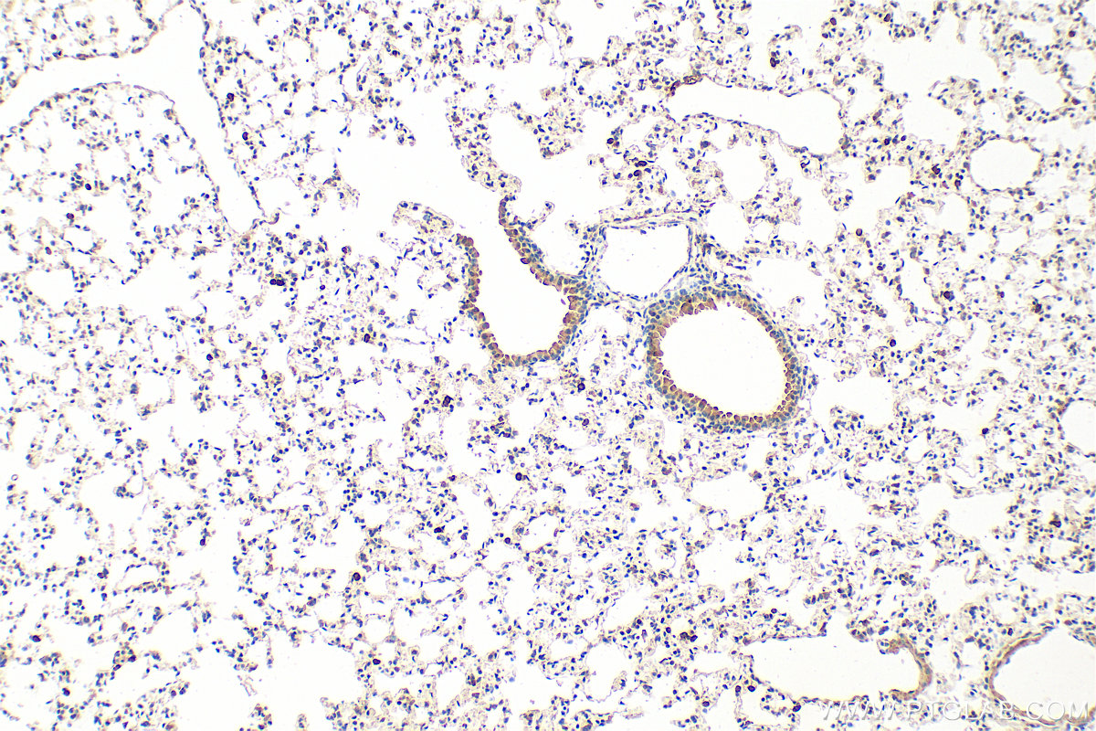 Immunohistochemistry (IHC) staining of mouse lung tissue using S100A8 Polyclonal antibody (15792-1-AP)