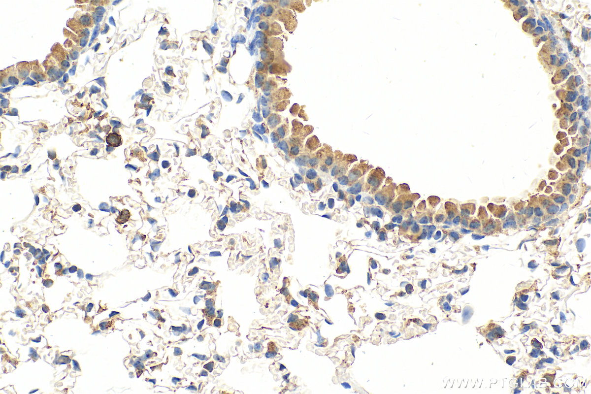 Immunohistochemistry (IHC) staining of mouse lung tissue using S100A8 Polyclonal antibody (15792-1-AP)